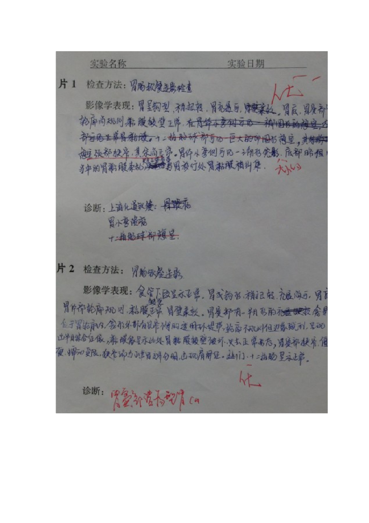 《放射诊断学》胃肿瘤实习报告