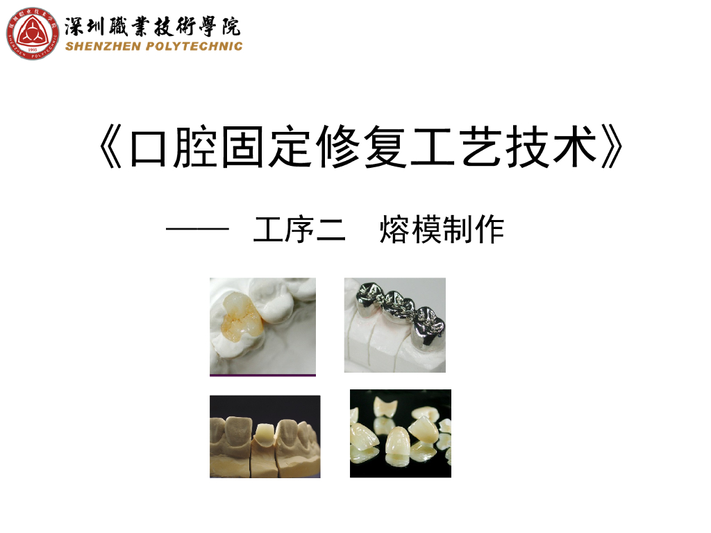 《口腔固定修复工艺技术》嵌体熔模制作