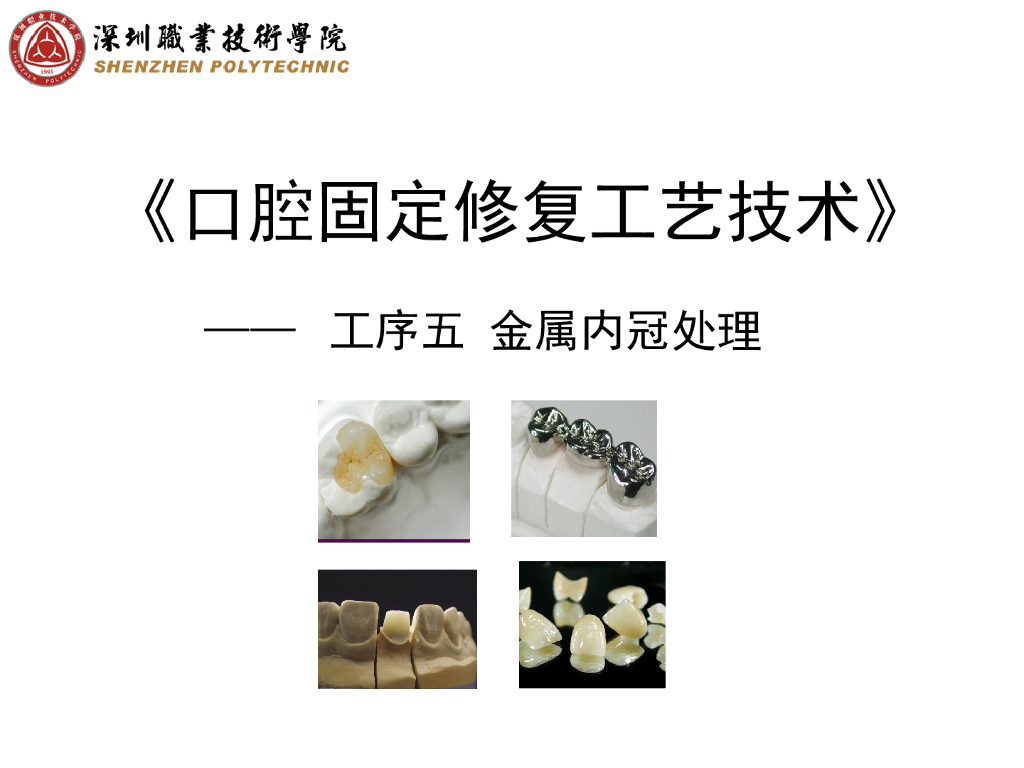 《口腔固定修复工艺技术》演示文稿-金属冠内冠处理