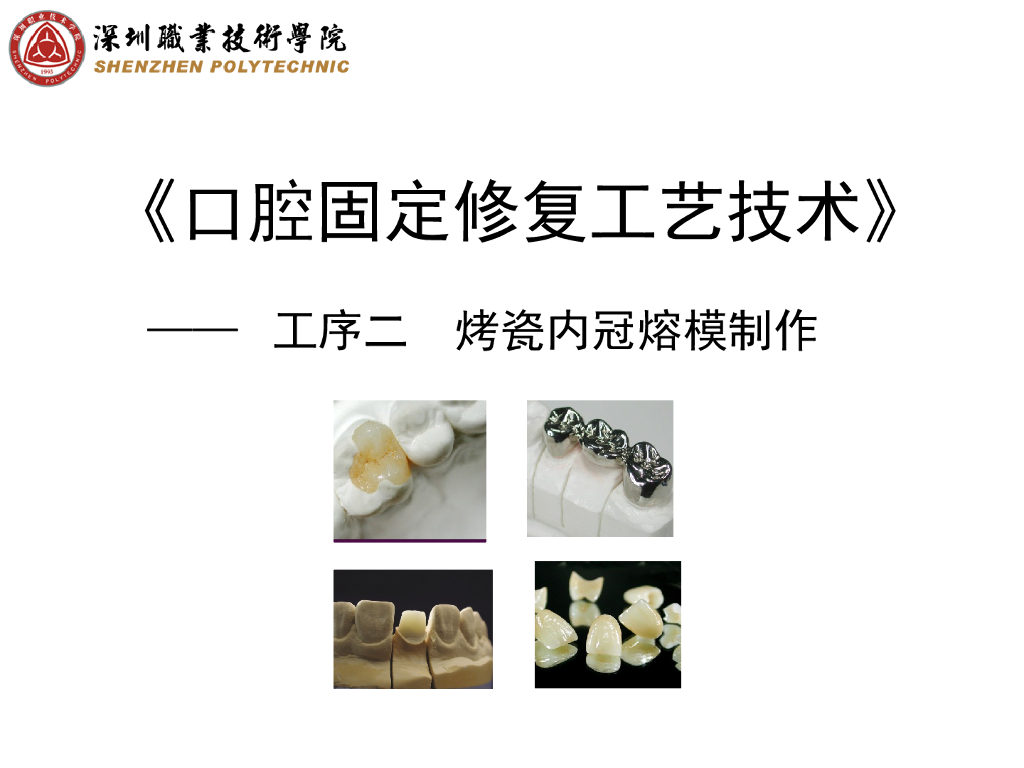 《口腔固定修复工艺技术》演示文稿-烤瓷内冠熔模制作