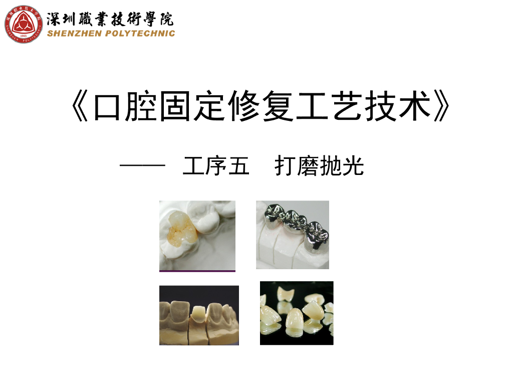 《口腔固定修复工艺技术》演示文稿-桩核打磨抛光