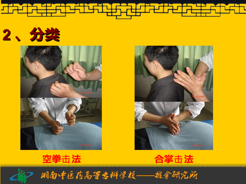 《推拿手法技术》演示文稿-拍法、击法_第5页