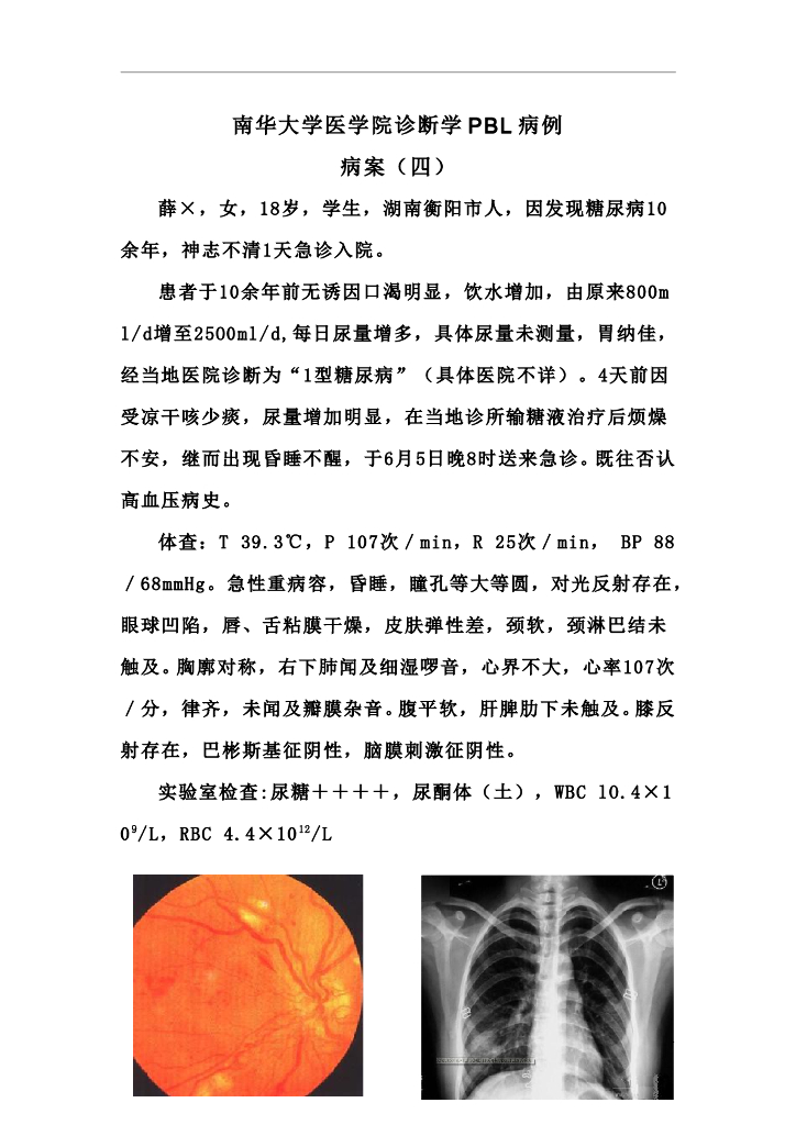 《临床技能学》教学案例-临床思维运用（选修）4—内分泌系统疾病PBL教学病例