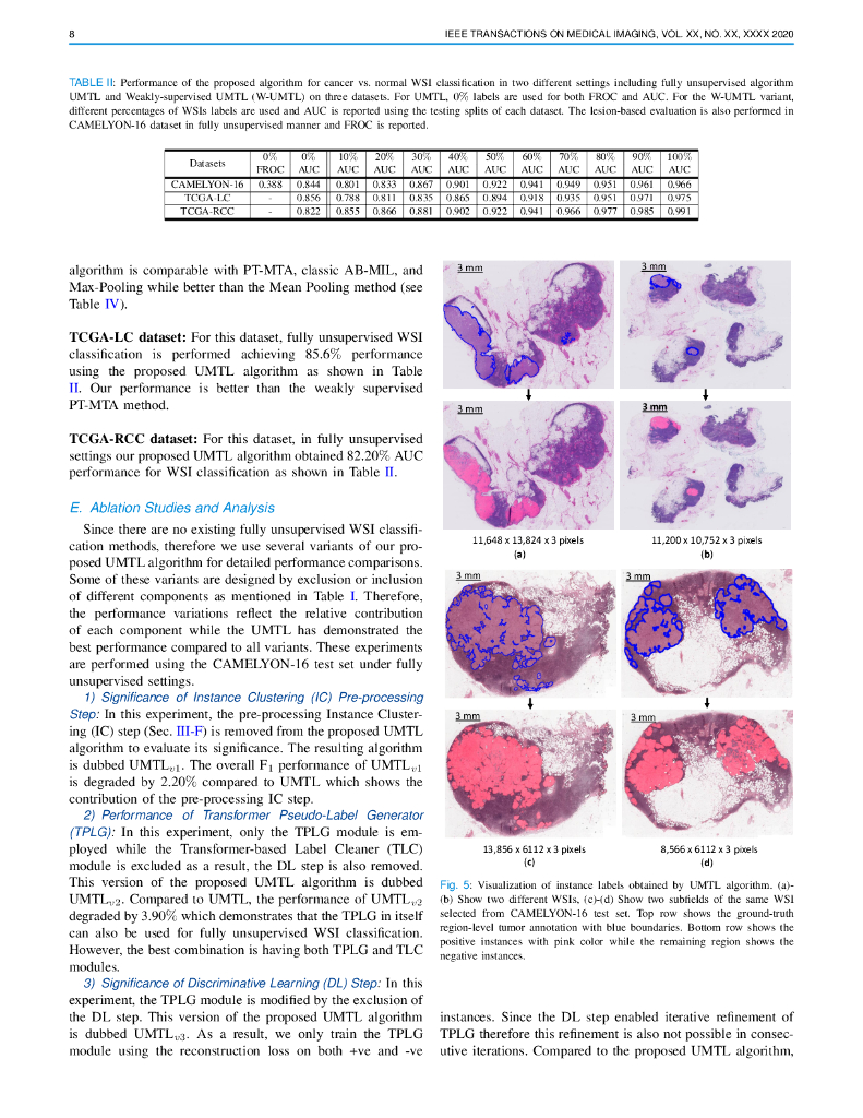 无监督互相转换器学习用于多千兆像素全切片图像分类（英文版）_第8页