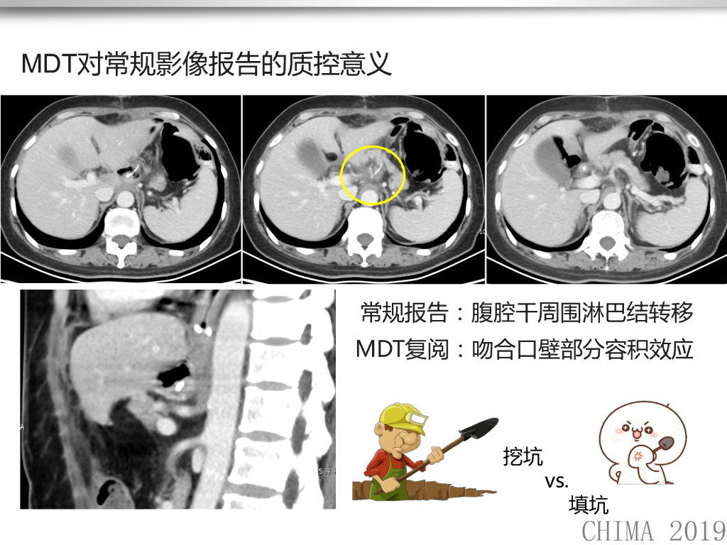 北京大学肿瘤医院（唐磊）：人工智能在肿瘤影像发展现状与展望_第8页