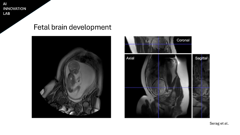 实验室到生活卡塔尔威尔康奈尔大学医疗保健领域的生成式人工智能创新_第7页