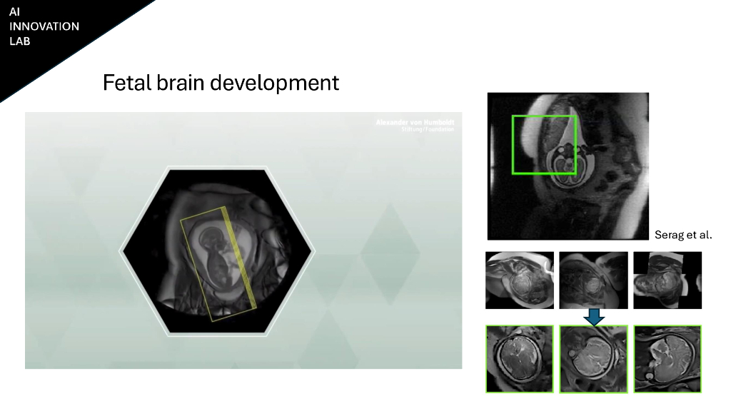 实验室到生活卡塔尔威尔康奈尔大学医疗保健领域的生成式人工智能创新_第8页