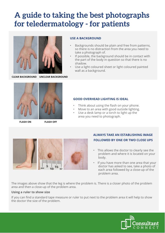 拍摄清晰的照片