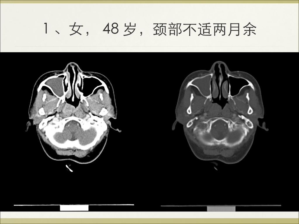 《放射诊断学》习题作业合集