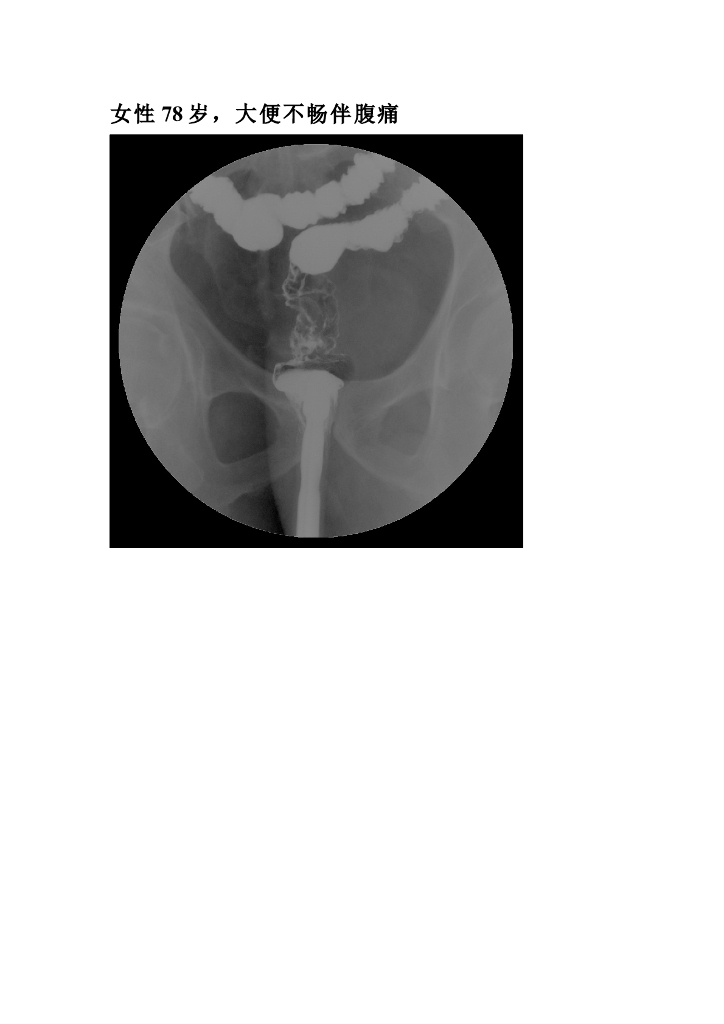 《放射诊断学》实验 实训 实习-合集
