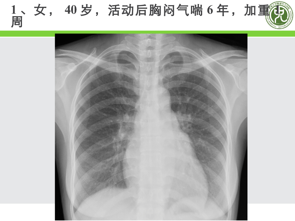 《放射诊断学》学习手册-循环系统 作业