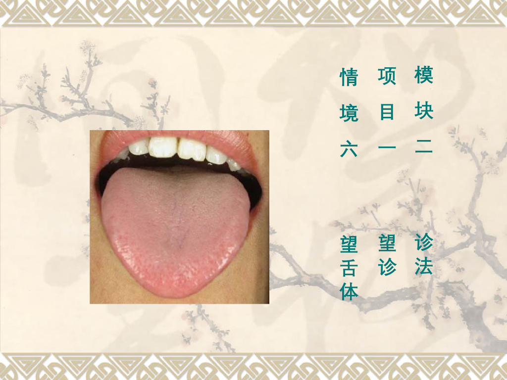 《中医诊断学》演示文稿-望舌体新增