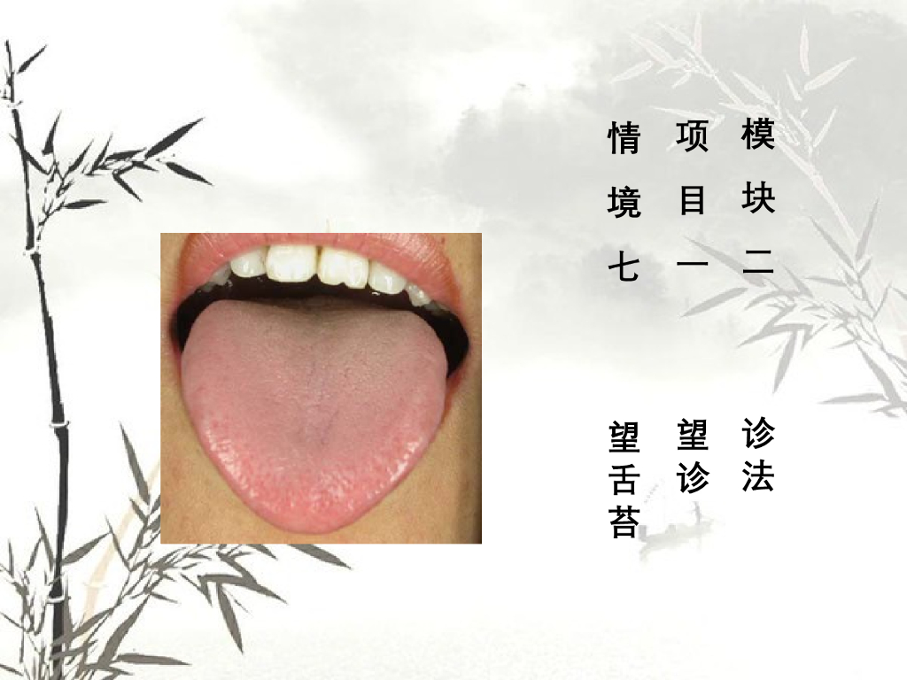 《中医诊断学》演示文稿-望舌苔新增