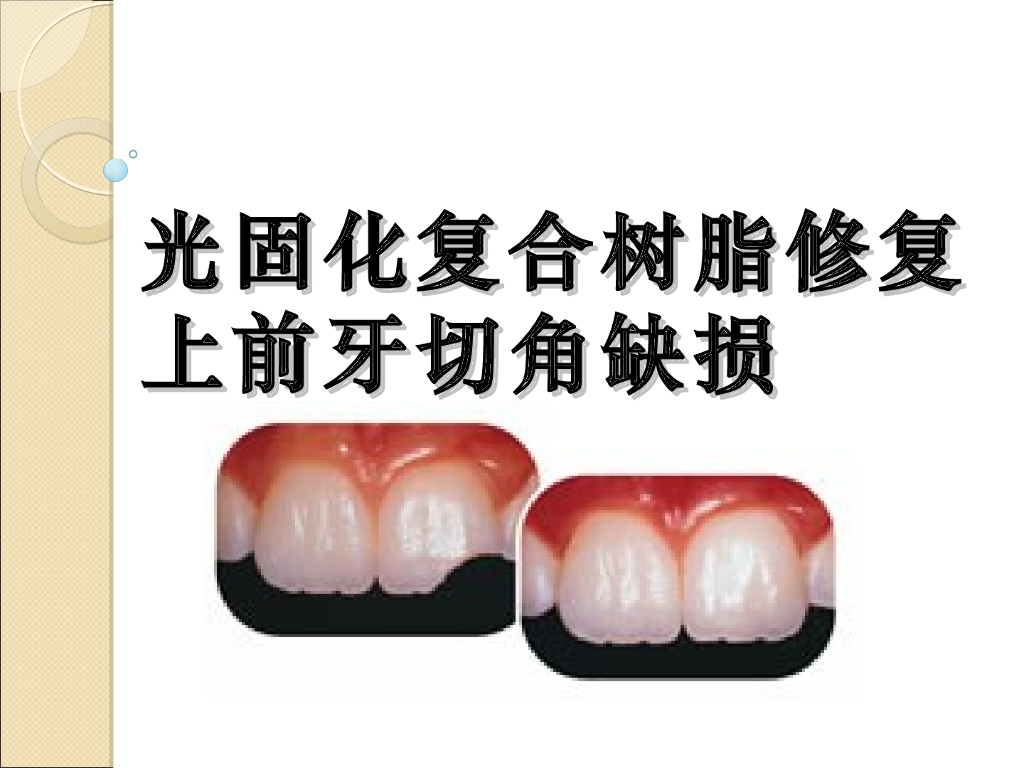 《口腔内科学》演示文稿-实验9（2小时）