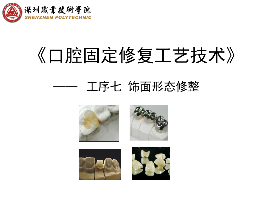 《口腔固定修复工艺技术》烤瓷熔附金属冠饰面形态修整