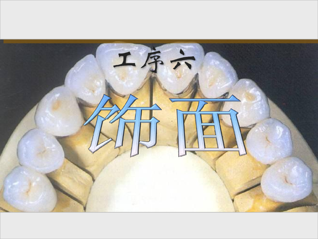 《口腔固定修复工艺技术》烤瓷熔附金属冠饰面