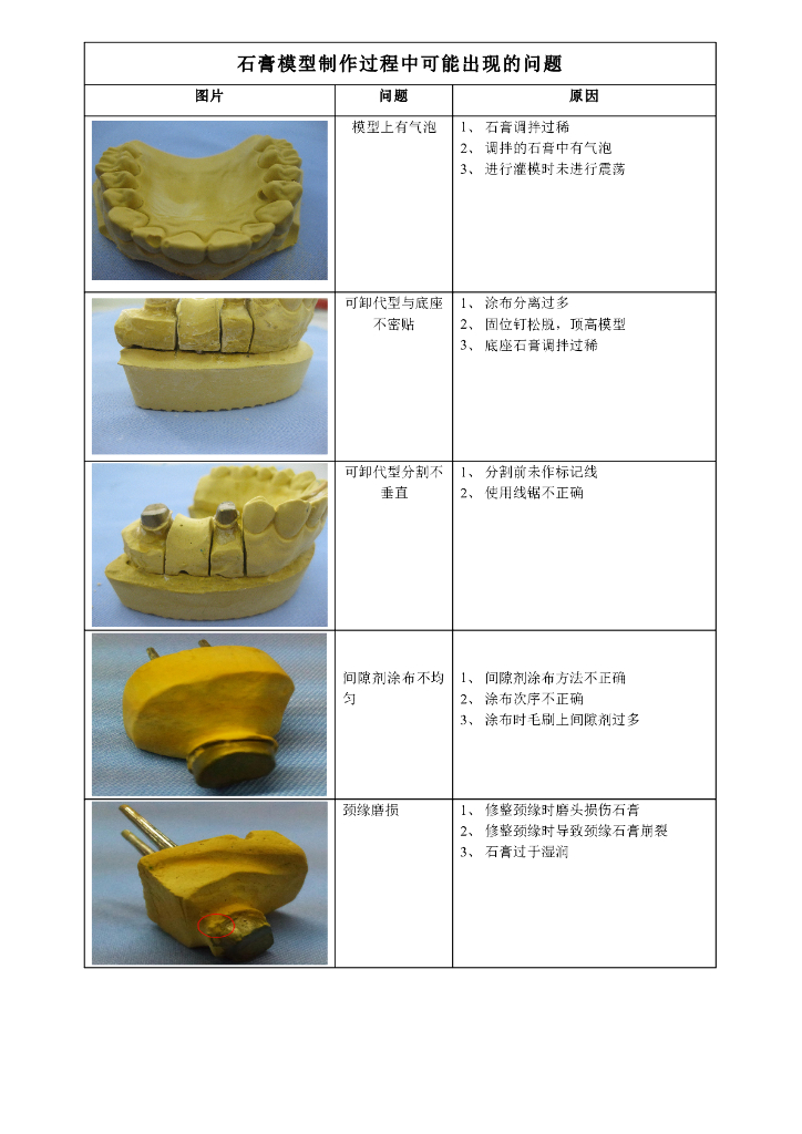 《口腔固定修复工艺技术》失败案例