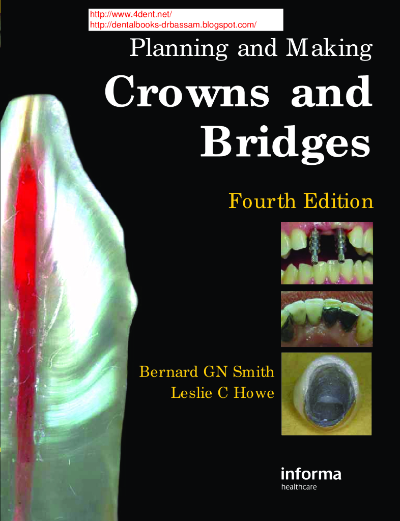 《口腔固定修复工艺技术》文献资料-冠桥设计与制作 planning and making crowns and bridges