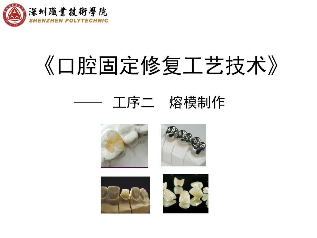 《口腔固定修复工艺技术》演示文稿-固定桥熔模制作