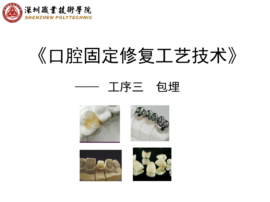 《口腔固定修复工艺技术》演示文稿-固定桥包埋