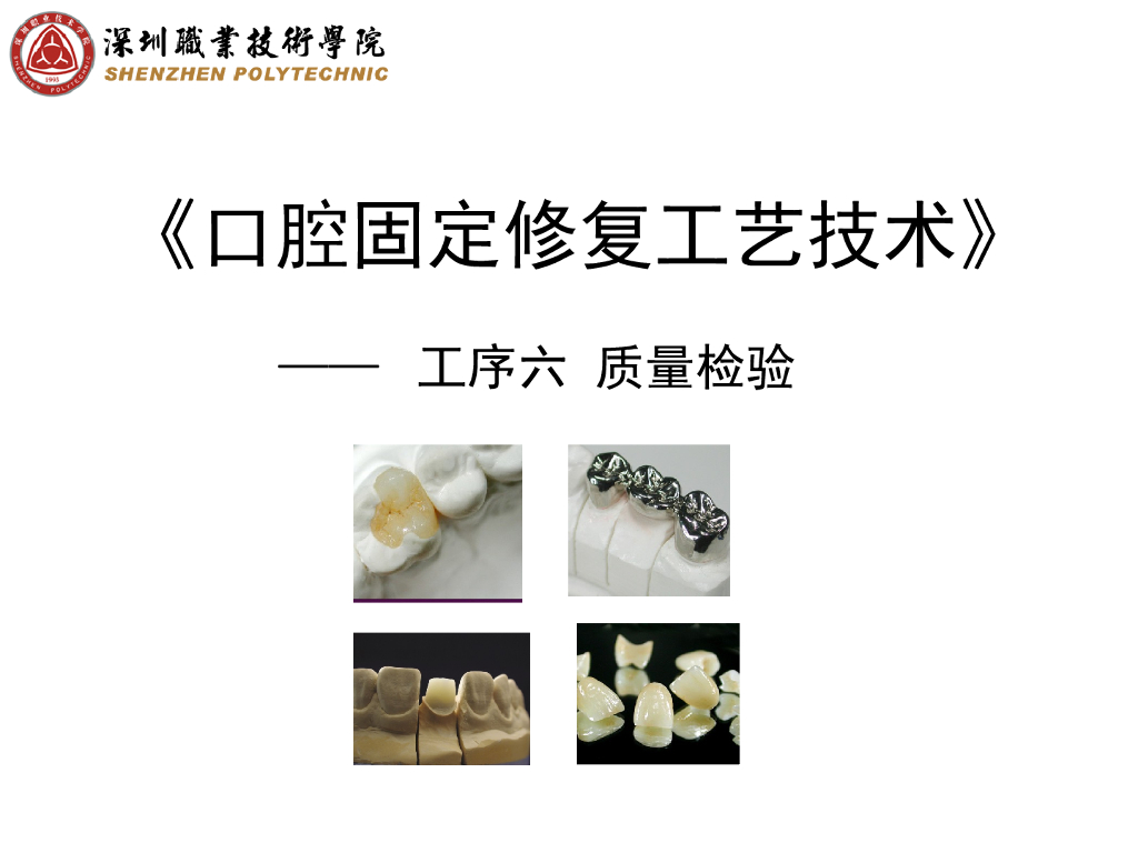 《口腔固定修复工艺技术》演示文稿-桩核质检