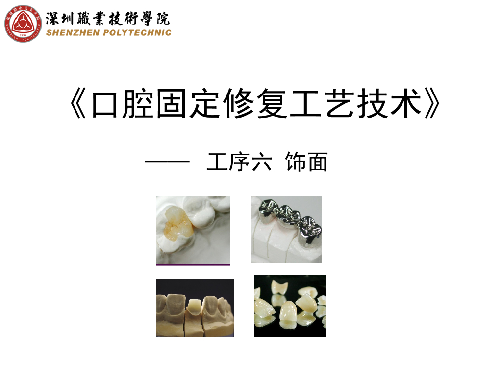 《口腔固定修复工艺技术》演示文稿-饰面