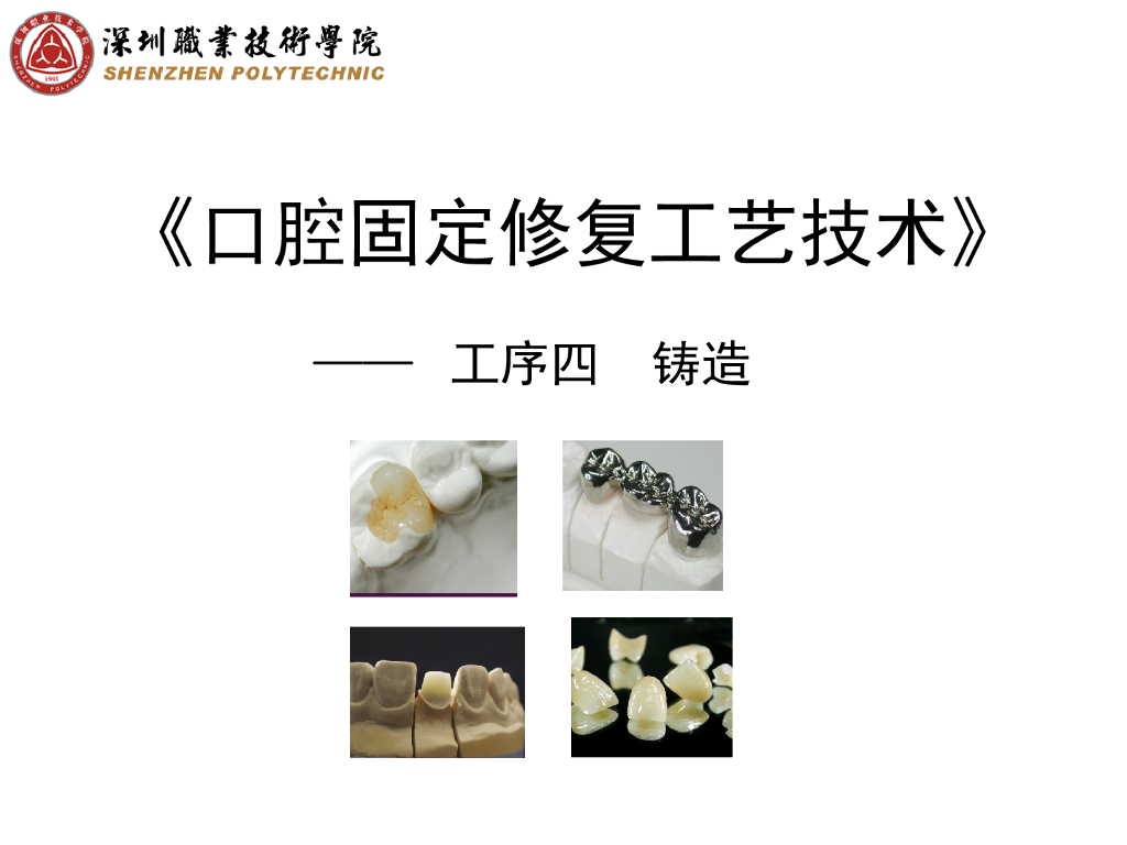 《口腔固定修复工艺技术》演示文稿-桩核铸造