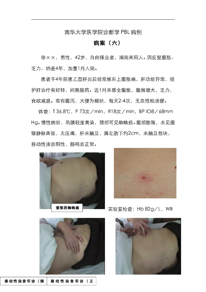 《临床技能学》教学案例-临床思维运用（选修）5—消化系统疾病PBL教学病例