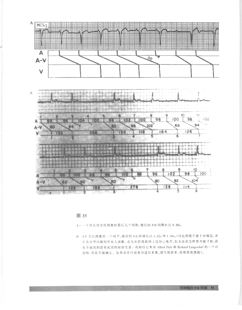 《临床技能学》文献资料-心电图的经验与教训2