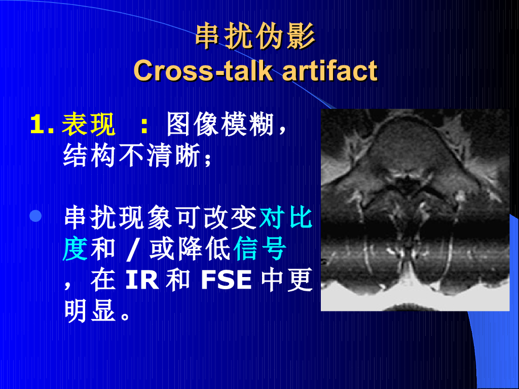 《现代医学成像技术》其他MR伪影