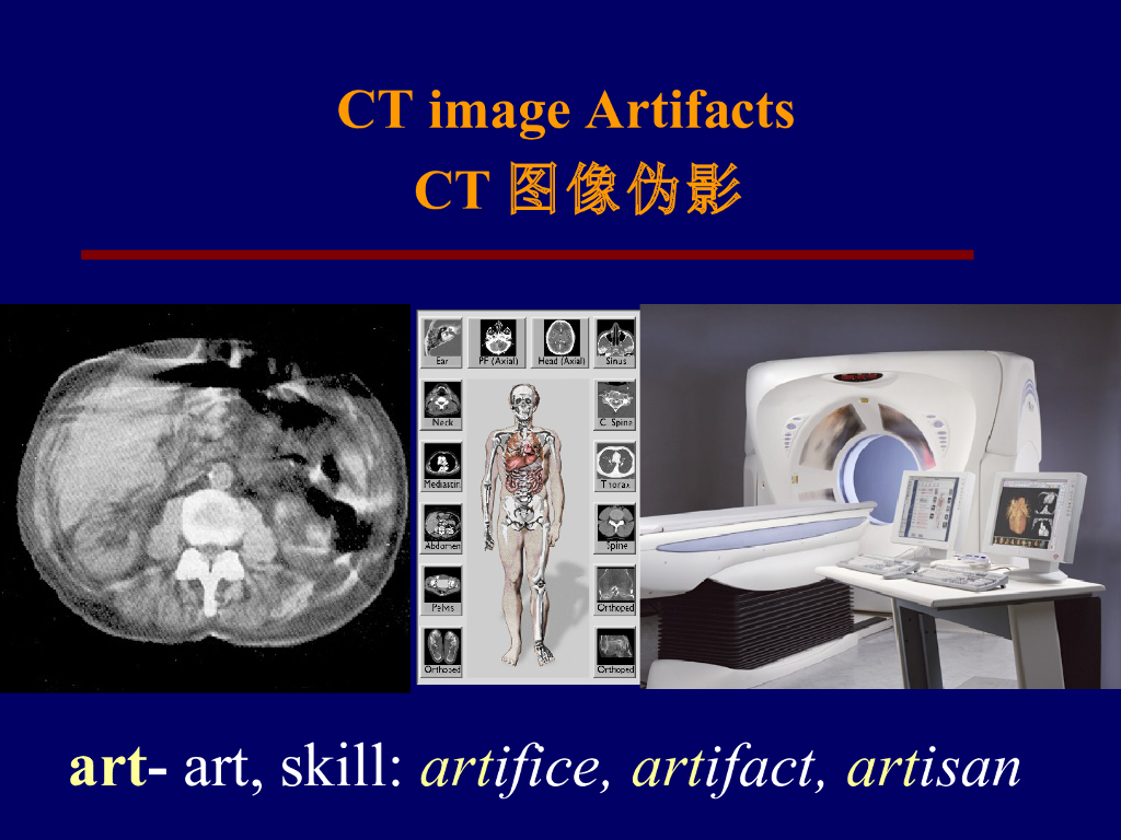 《现代医学成像技术》CT图像伪影