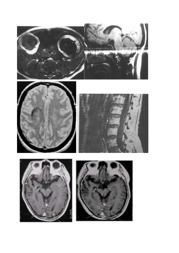 《现代医学成像技术》MRI伪影素材库