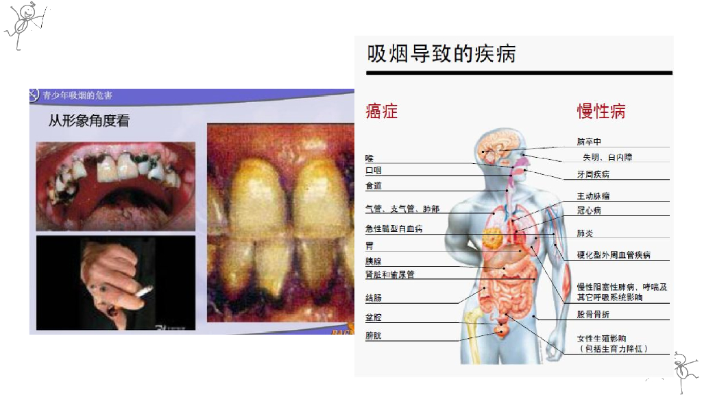 五年级上册道德与法治课件-3.主动拒绝烟酒与毒品第一课时 人教（新版） (共14张PPT)_第7页