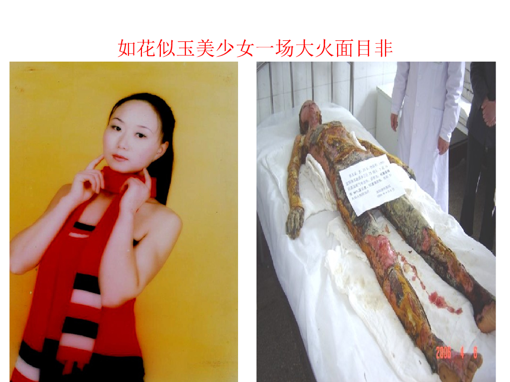 海南海口市滨海第九小学消防常识课件_第7页