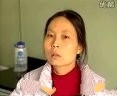消化系统常用诊疗技术