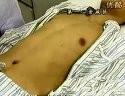 国家执业医师资格考试实践技能(包括助理)