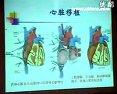 心力衰竭的非药物治疗方法教学