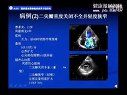 风湿性心脏病与心力衰竭的诊断治疗