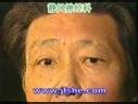 常见神经疾病的症状表现形式