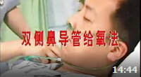 双侧鼻导管给氧技术的操作教学