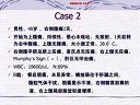 胆结石的临床分型和治疗措施