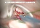 海绵状血管瘤手术操作过程