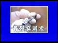 骨髓穿刺术的详细操作过程教学