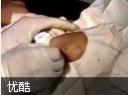 针刀医学教程