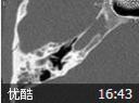 影像学教学视频