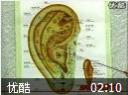 耳穴按摩巧治病