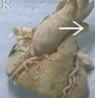 人体动脉血管的解剖