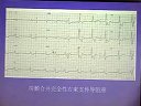 心房颤动-兰州大学第二医院课程
