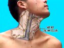 颈部解剖知识视频讲课