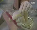 fish（荧光原位杂交）技术的医学应用方法